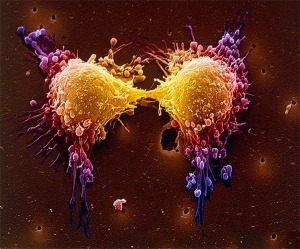 cancer-cell-division-spl-and-photo-researchers1